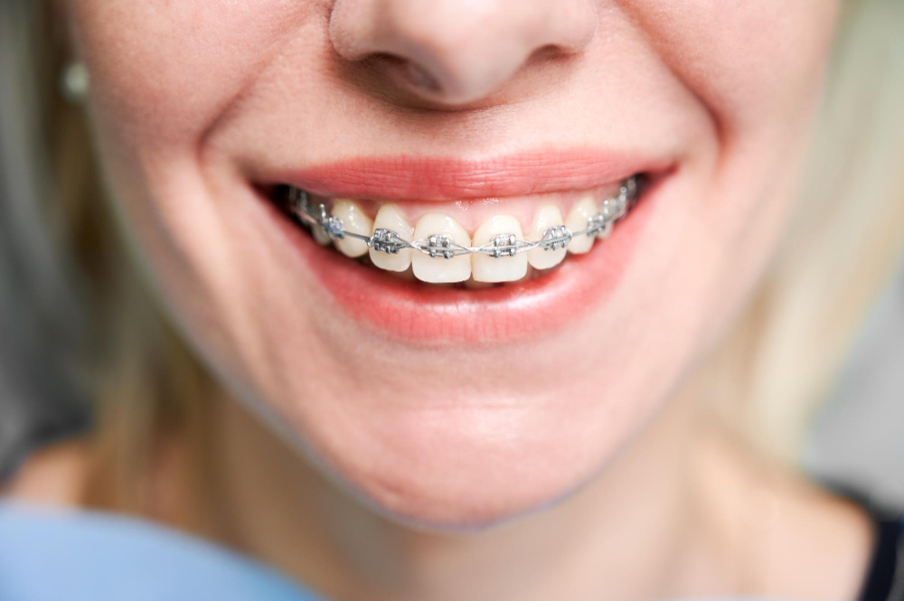 orthodontic services Pickerington, OH